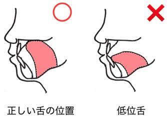 レス1の画像1