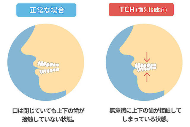 レス61の画像1